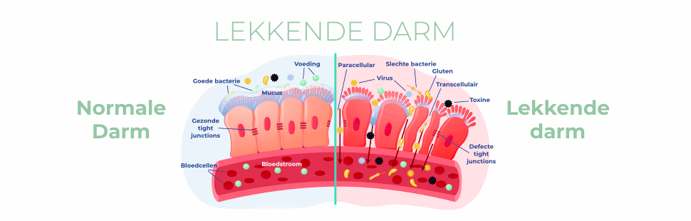 lekkende darm lekkende darm